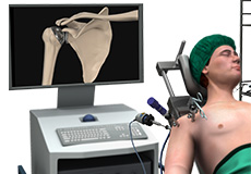 Minimally Invasive Shoulder Joint Replacement